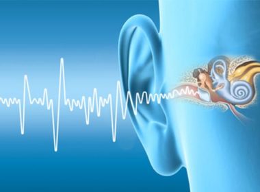 perda auditiva neurossensorial